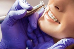 عدد سنوات دراسة طب الأسنان في مصر
