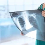 تخصص الأشعة والتصوير الطبي في الجامعات المصرية