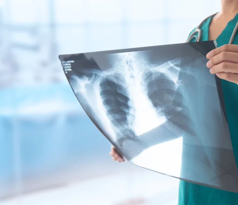 تخصص الأشعة والتصوير الطبي في الجامعات المصرية للوافدين